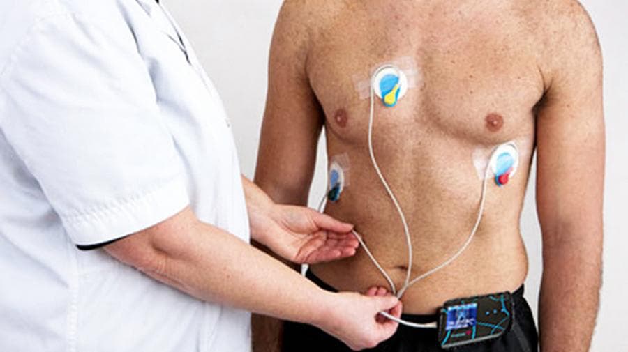 How to prepare for an ECG holter?